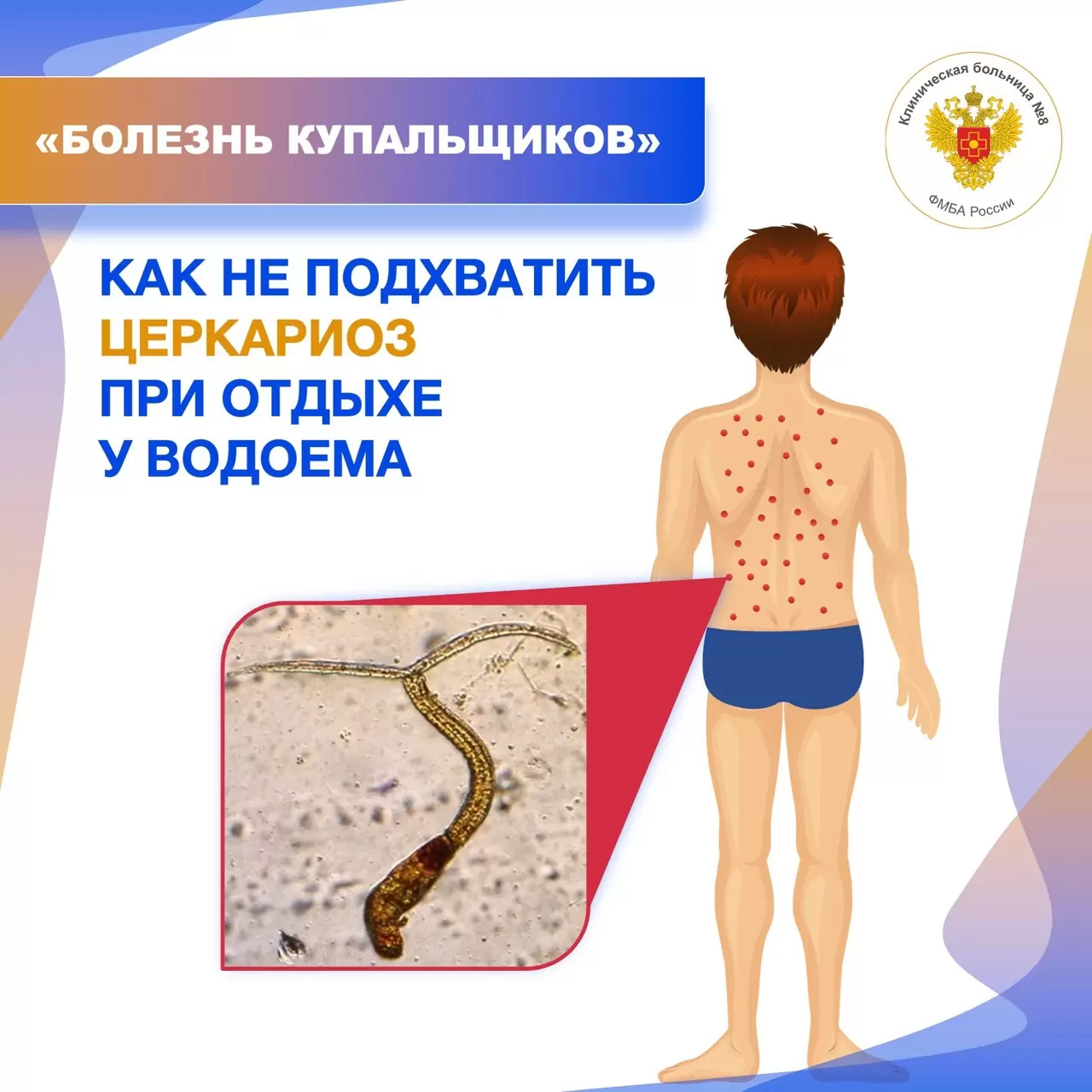 «Болезнь купальщиков»: как не подхватить церкариоз при отдыхе у водоема