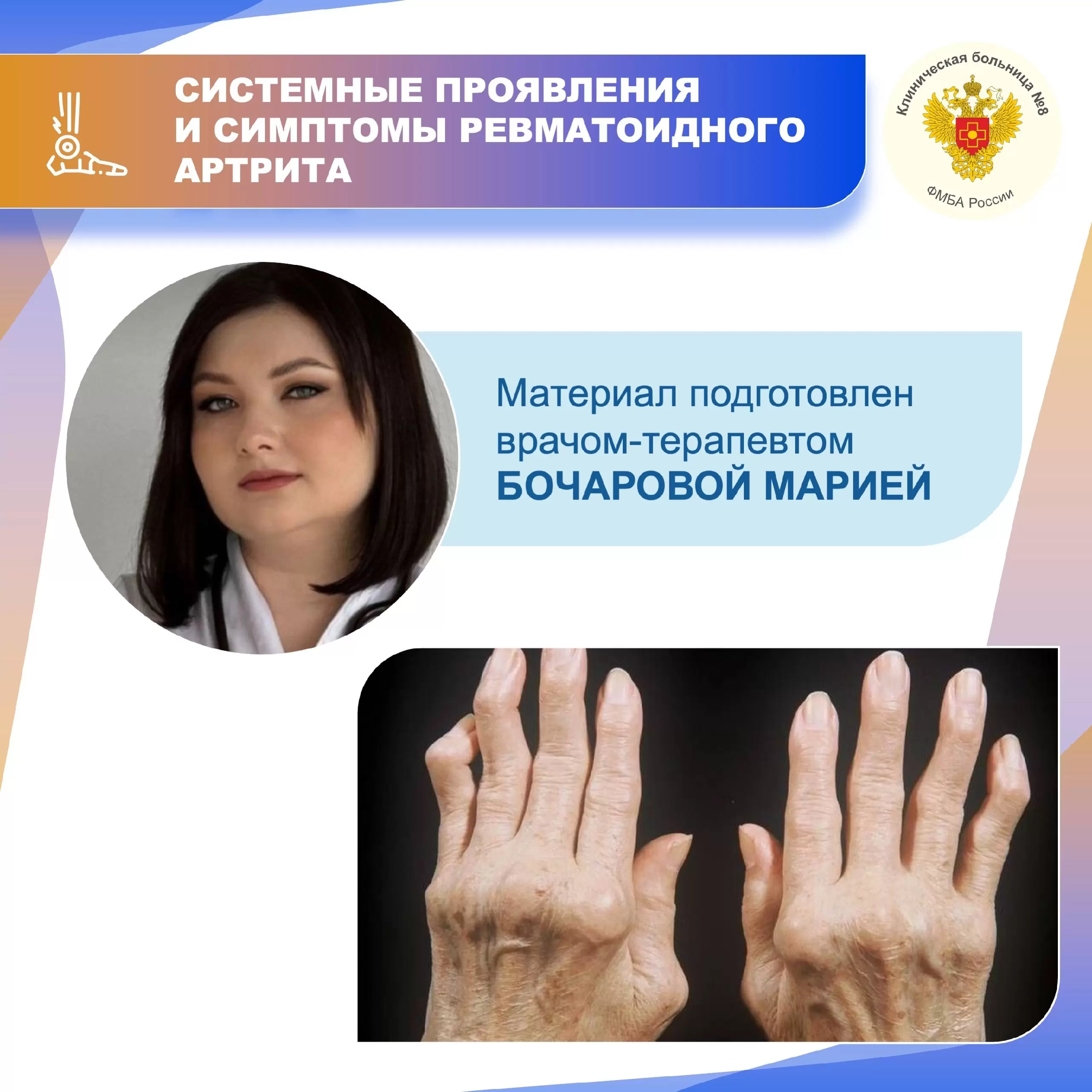 Ревматоидный артрит: причины, симптомы и лечение