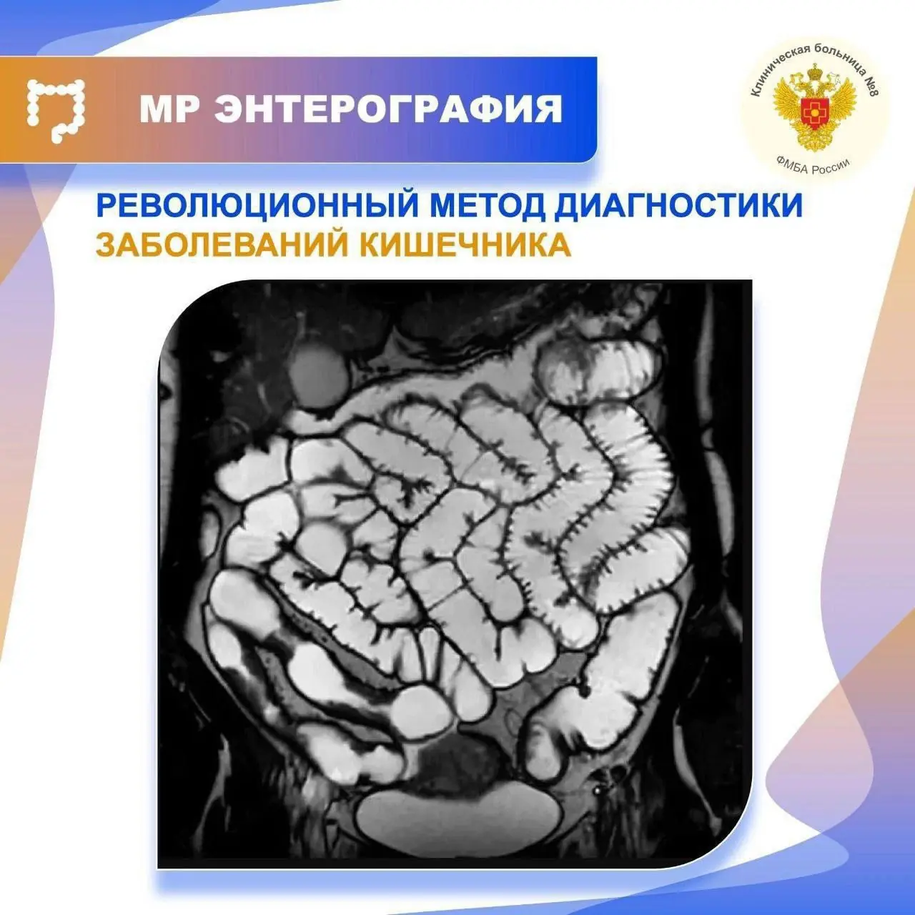 Магнитно-резонансная энтерография революционный метод диагностики заболеваний кишечника