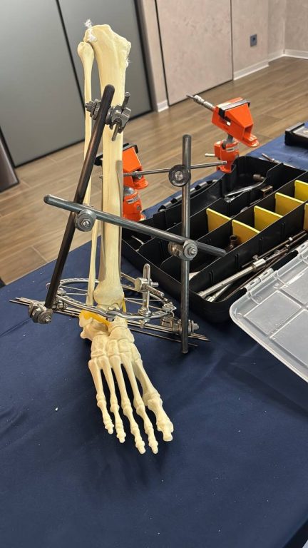 estsmeyd4oezzknt6m9ejd4jedvkxxngcqrrmx6b5xyernh6hcxjvm4q619z0mxu8q xv8h we0ycaj2cuijlmxe