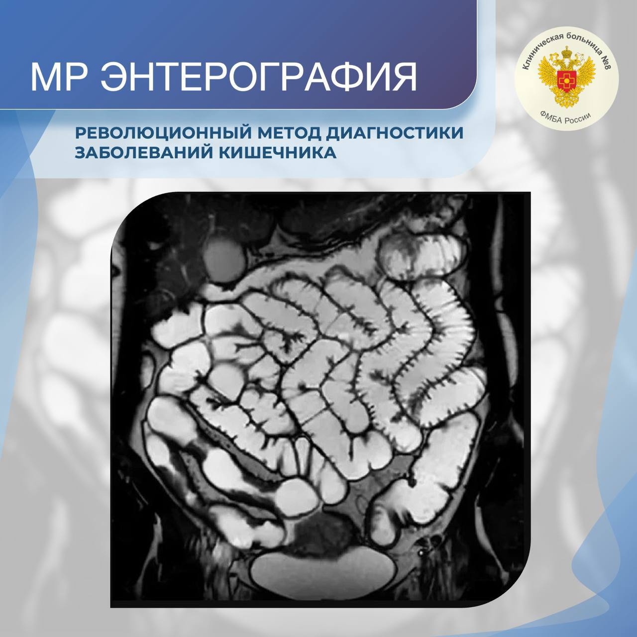 Революционный метод диагностики заболеваний кишечника