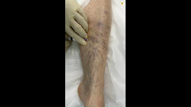 Видео превью