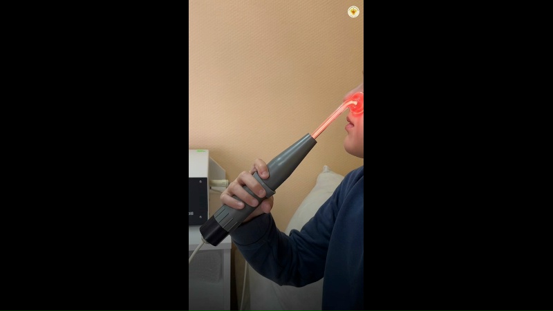 Видео превью