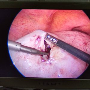 hjzjqq3vkmvub7q3l1wmai7tlzvjyloe7oqjolqzg t vrgwmwktajolgcrrw4itsrnagqaoxvmyp77ygpplfbql