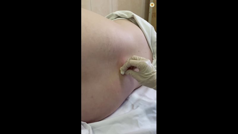 Видео превью