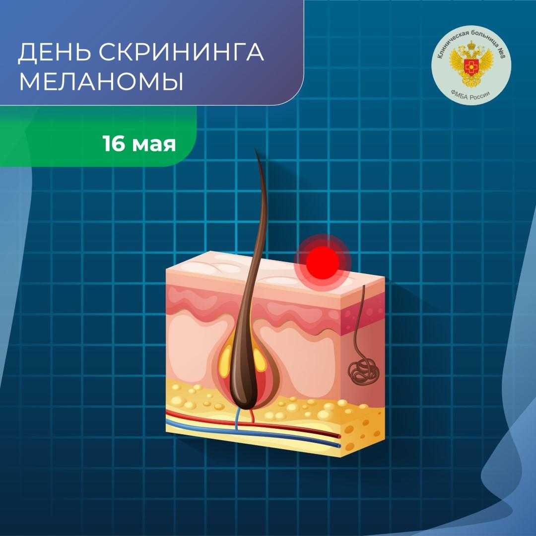 16 мая 2025 года объявлен ФМБА России  Днём борьбы против меланомы среди медицинских учреждений Агентства.