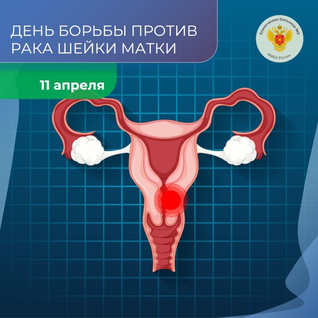 11 апреля 2025 года объявлен ФМБА России Днём борьбы против рака шейки матки среди медицинских учреждений Агентства