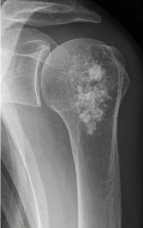 2efab8ae 3e9e 4006 be78 ed05f070