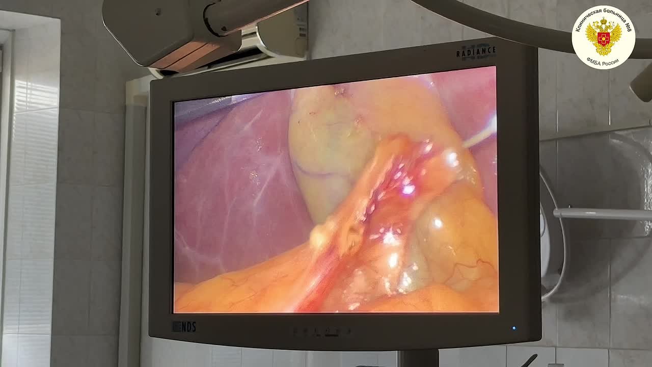 Видео превью